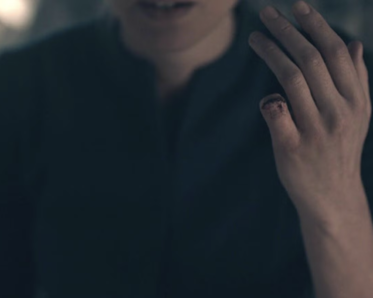 why did Serena lose her finger